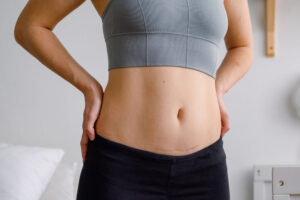 Blizna po cesarskim cięciu