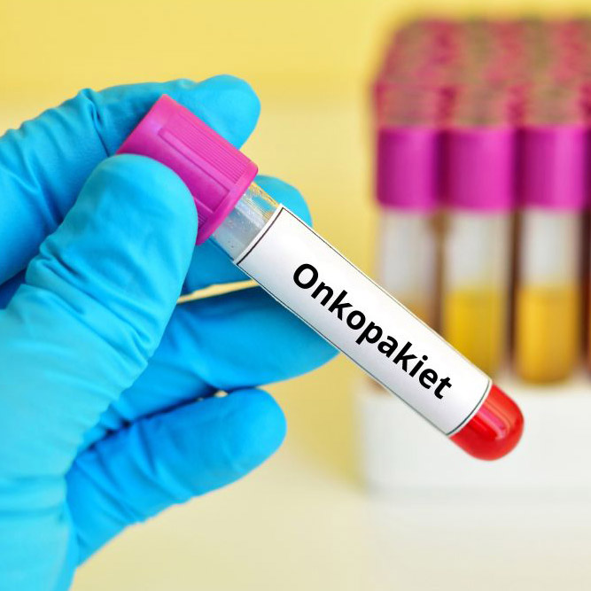 Onkopakiet – badanie poziomu pierwiastków we krwi